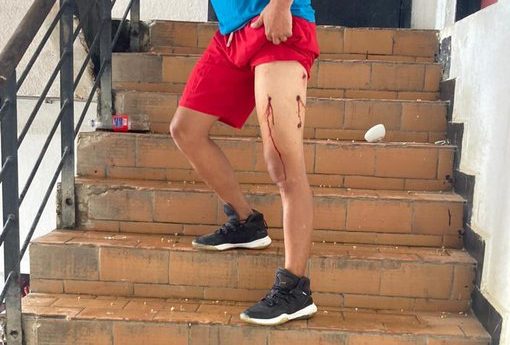 Partido de Machado reporta disparos de militares a reos "políticos" en cárcel venezolana