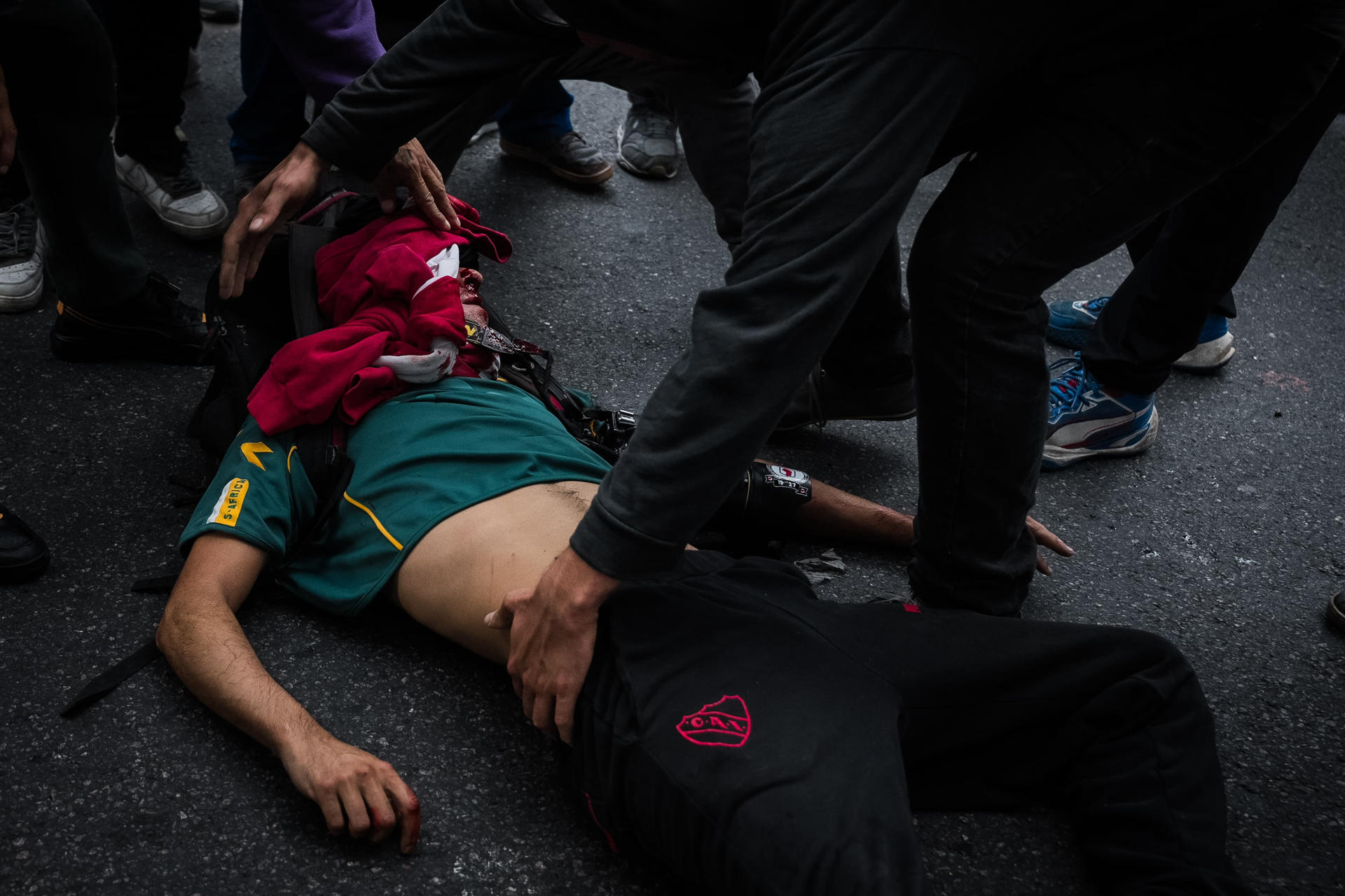 El fotógrafo argentino Pablo Grillo, en estado grave por disparo de la Policía en protesta
