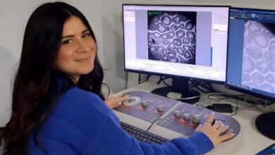 Científica venezolana en Chile realiza descubrimiento clave sobre el Parkinson