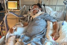 Un venezolano lucha por su vida en Virginia: Su familia pide ayuda urgente
