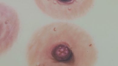 Arte que reconstruye identidad: EOLA MedArt y el impacto emocional de las prótesis de pezón hiperrealistas (+VIDEOS)