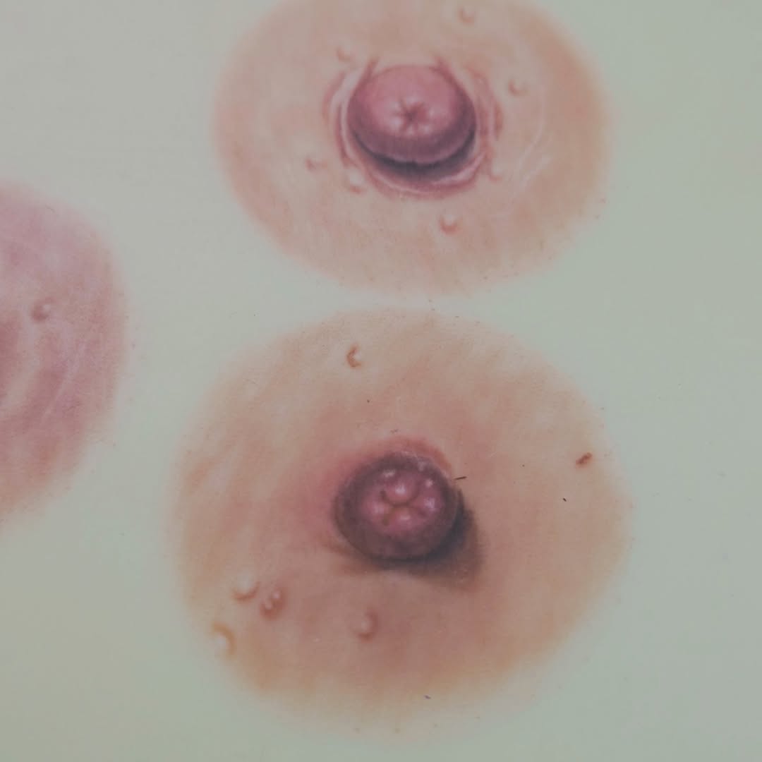 Arte que reconstruye identidad: EOLA MedArt y el impacto emocional de las prótesis de pezón hiperrealistas (+VIDEOS)