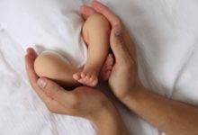 Utah amplía pruebas neonatales e incorpora el síndrome de Hunter a su panel de detección