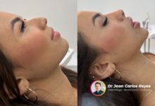 Cómo Instagram y TikTok están cambiando la percepción de la belleza y la autoestima