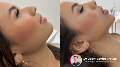 Cómo Instagram y TikTok están cambiando la percepción de la belleza y la autoestima