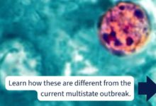 Utah registra 48 casos de ciclosporiasis, pero descarta vínculo con el brote nacional en Estados Unidos