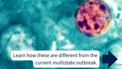 Utah registra 48 casos de ciclosporiasis, pero descarta vínculo con el brote nacional en Estados Unidos
